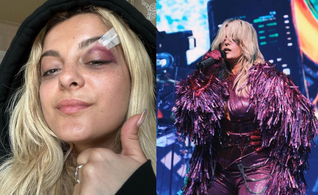 Bebe Rexha injured from the concert